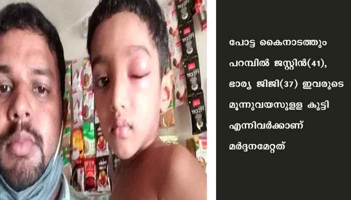 ബൈക്കിലെത്തിയ സംഘം കടയുമയുടെ വീട്ടില്‍ കയറി ആക്രമിച്ചു