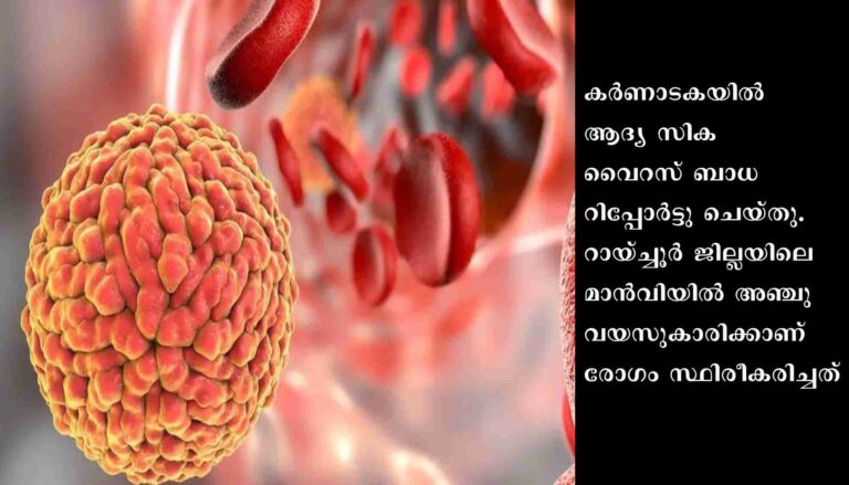 കര്‍ണാടകയില്‍ ആദ്യ സിക വൈറസ് റിപ്പോര്‍ട്ട് ചെയ്തു; രോഗം ബാധിച്ചത് അഞ്ചുവയസുകാരിക്ക്