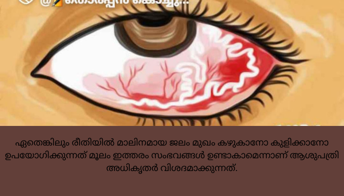 യുവതിയുടെ കണ്ണിൽ വിര