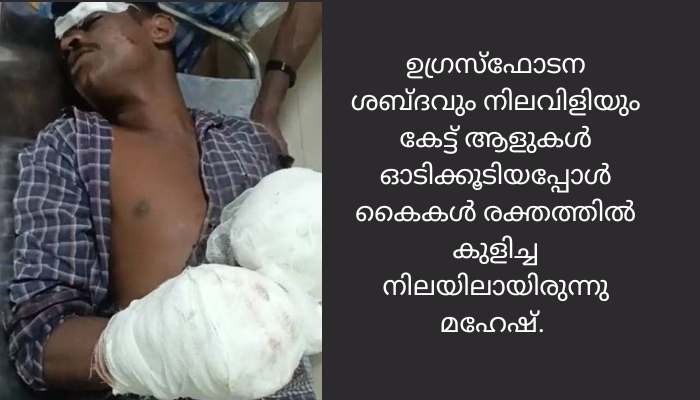 പറമ്പിൽ ജോലിചെയ്യുന്നതിനിടെ പന്നിപ്പടക്കം പൊട്ടി യുവാവിന്റെ കൈപ്പത്തി തകർന്നു
